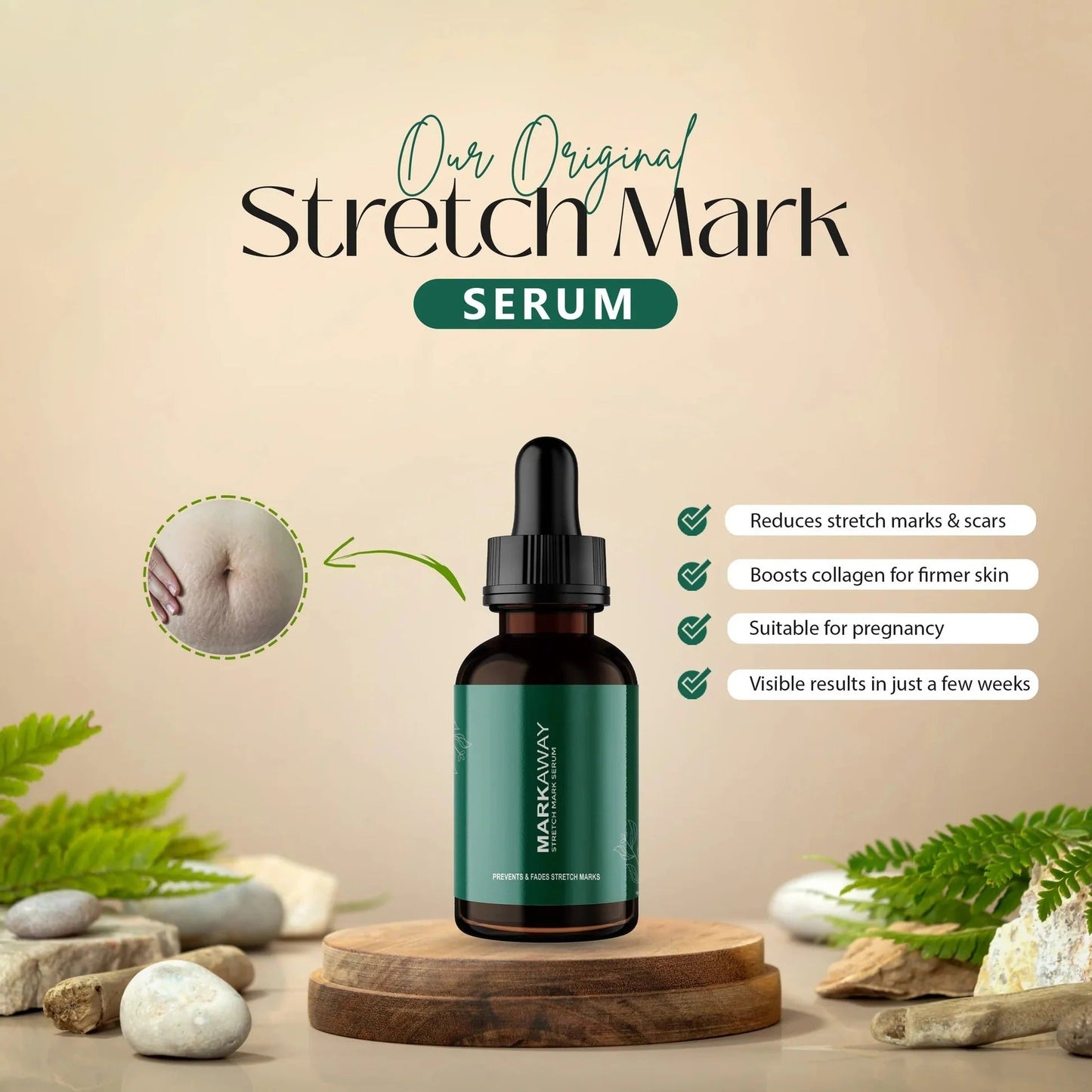 Markaway Stretch Mark Serum (Buy 1 Get 1 Free)